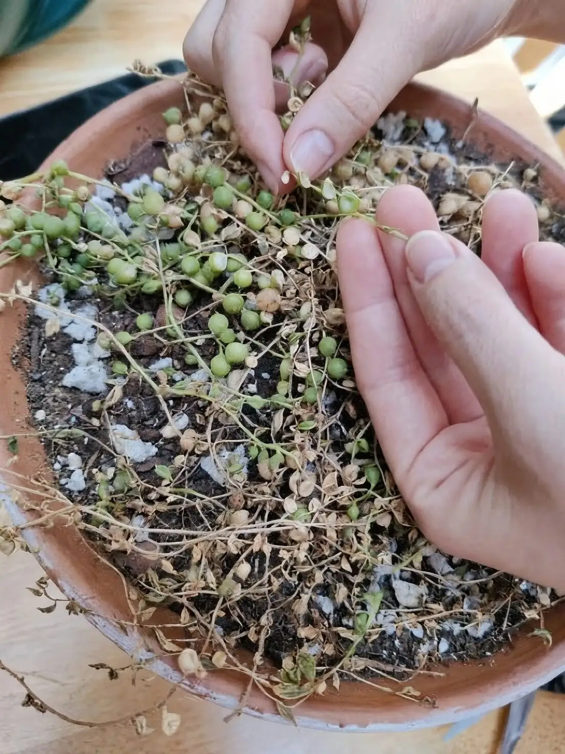 string of pearls sunburn close up